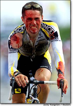Cyclist bloody from a crash