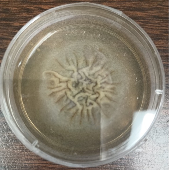 Coccidioides posadasii