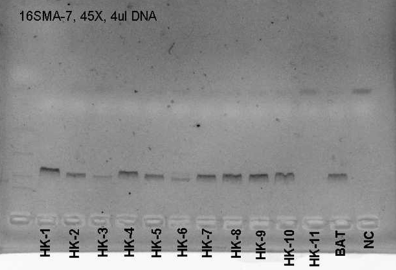 PCR Results